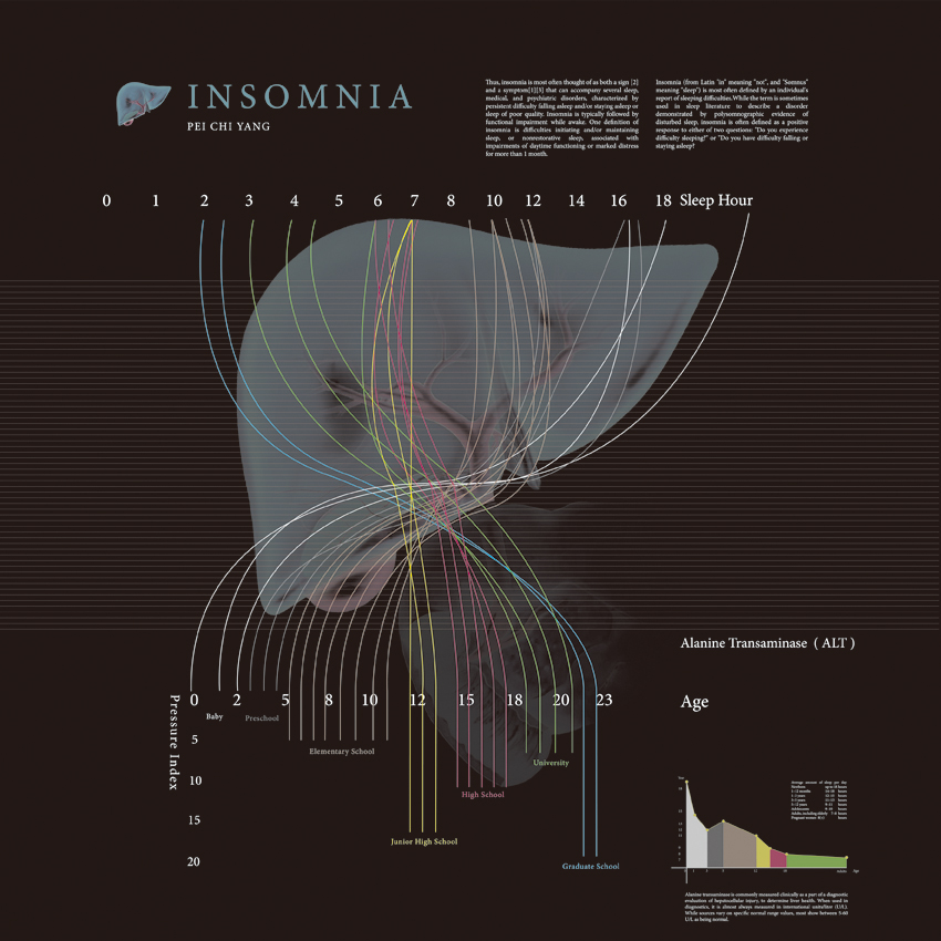 Insomnia
